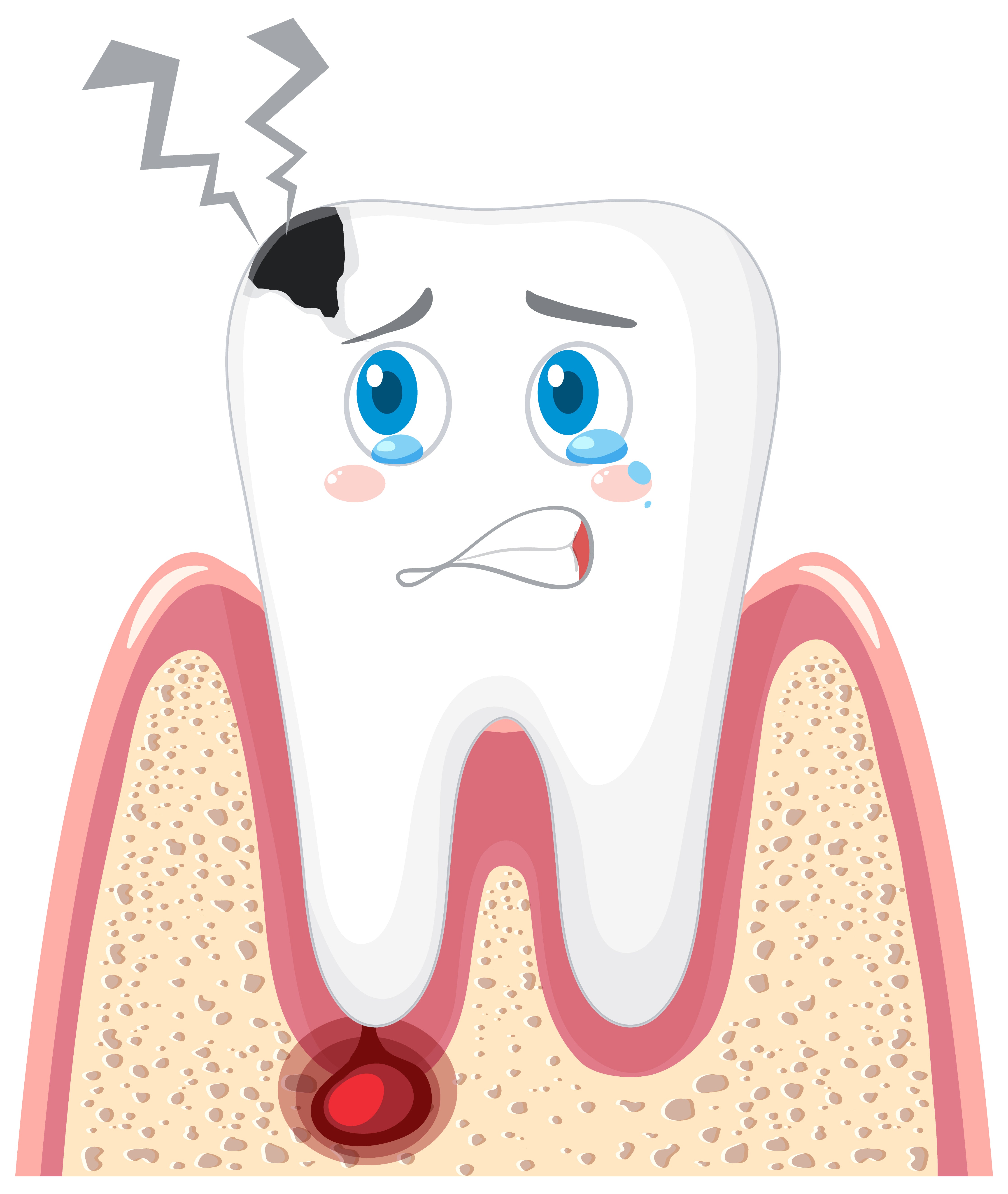Natural Remedies and Herbal Toothpaste for Bleeding Gums